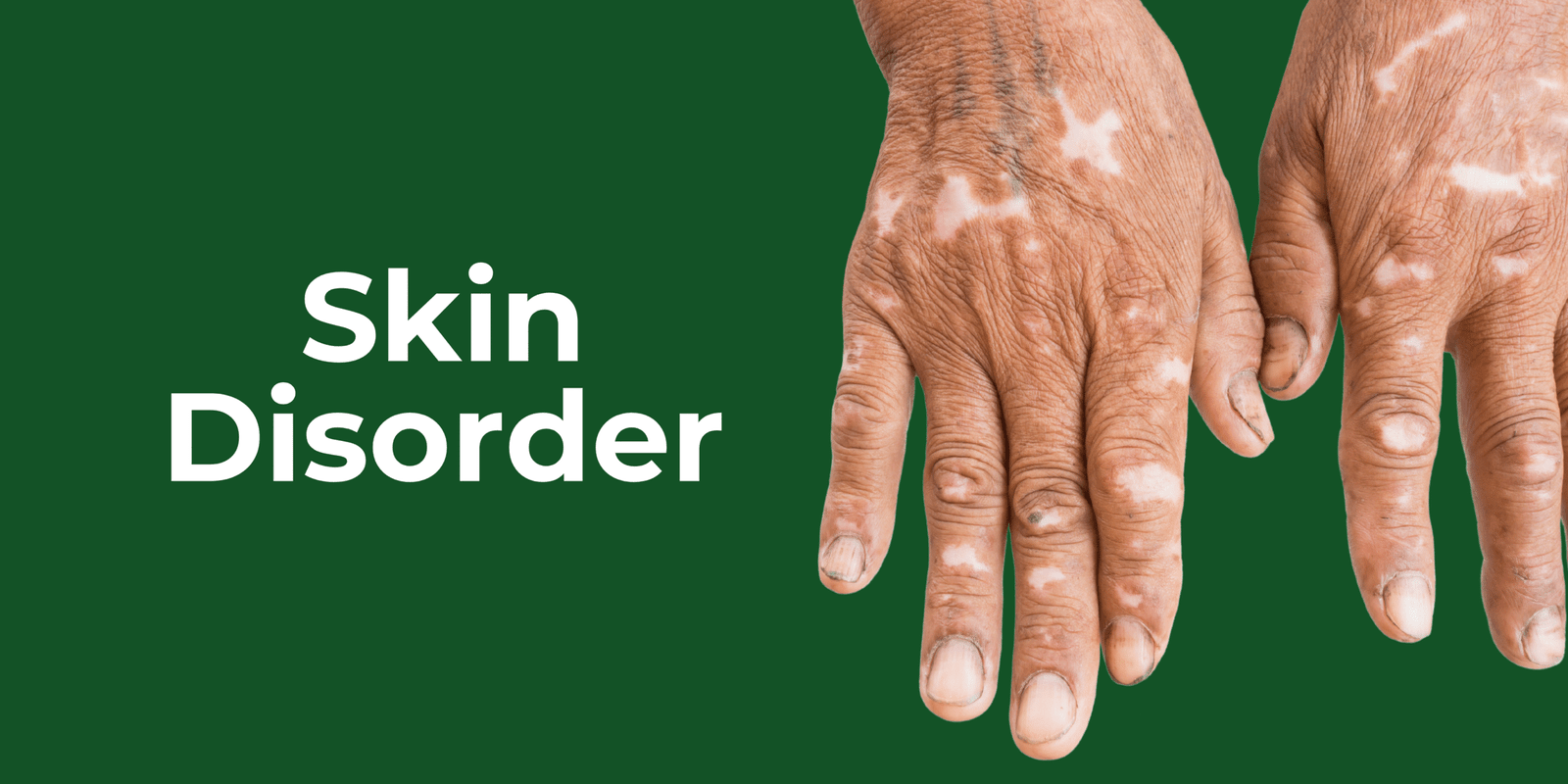 Skin Disorder