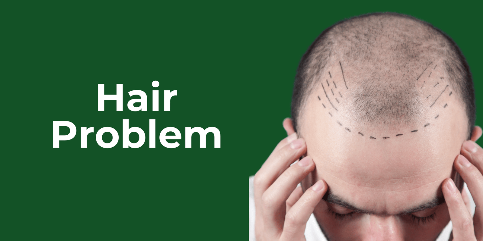 Hair Problem